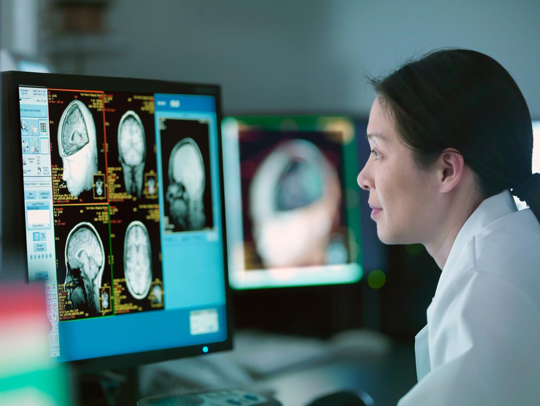 The Role of a Neurologist in Diagnosing and Treating Brain Disorder